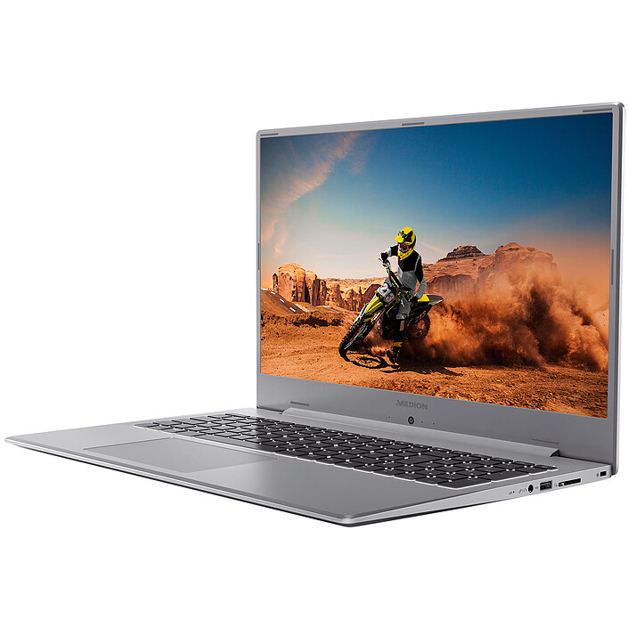 Avis Medion Akoya S17201 (MD 30032622)